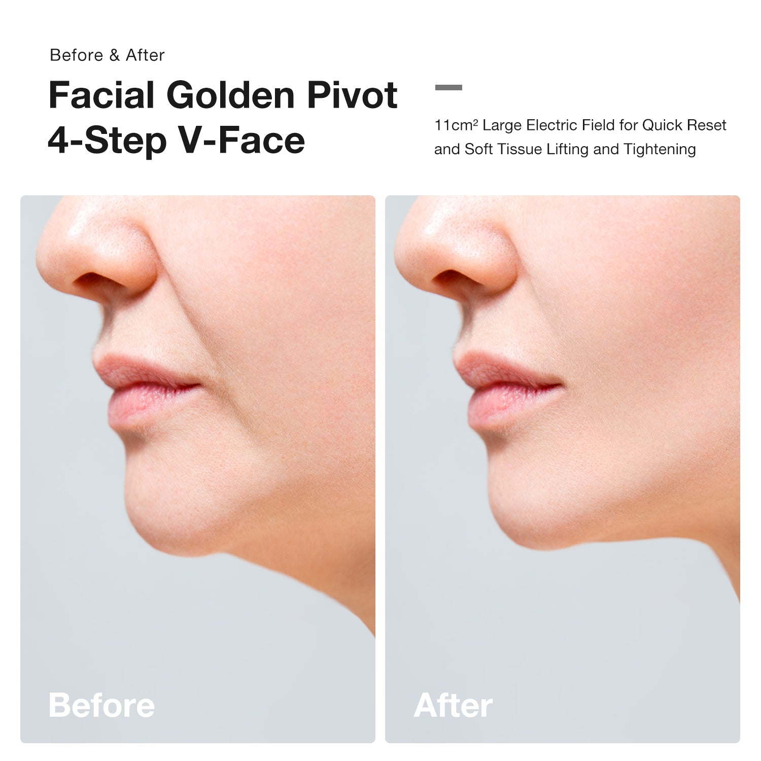 JOVS Slimax Microcurrent Anti-aging Device